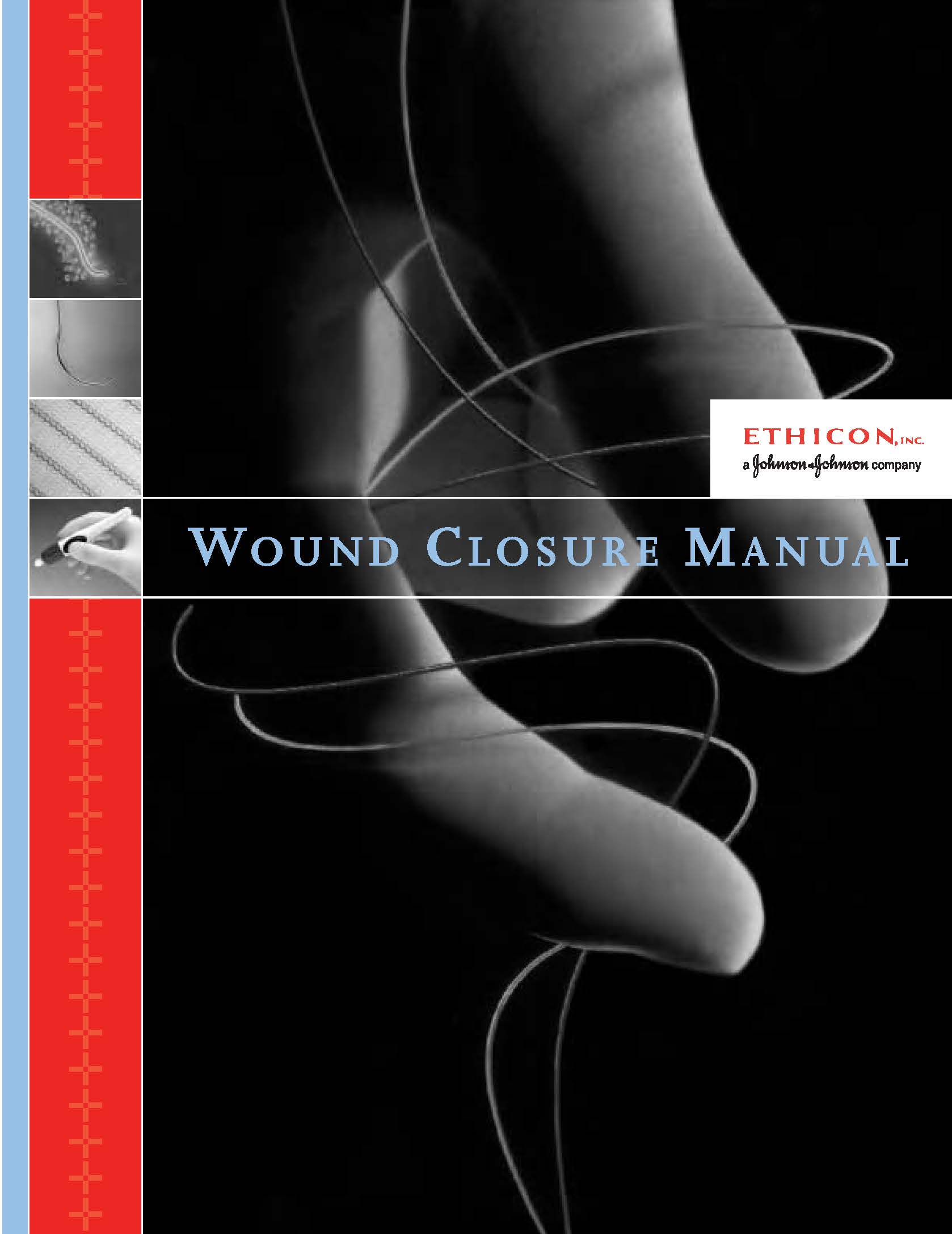 Ethicon Wound Closure Manual